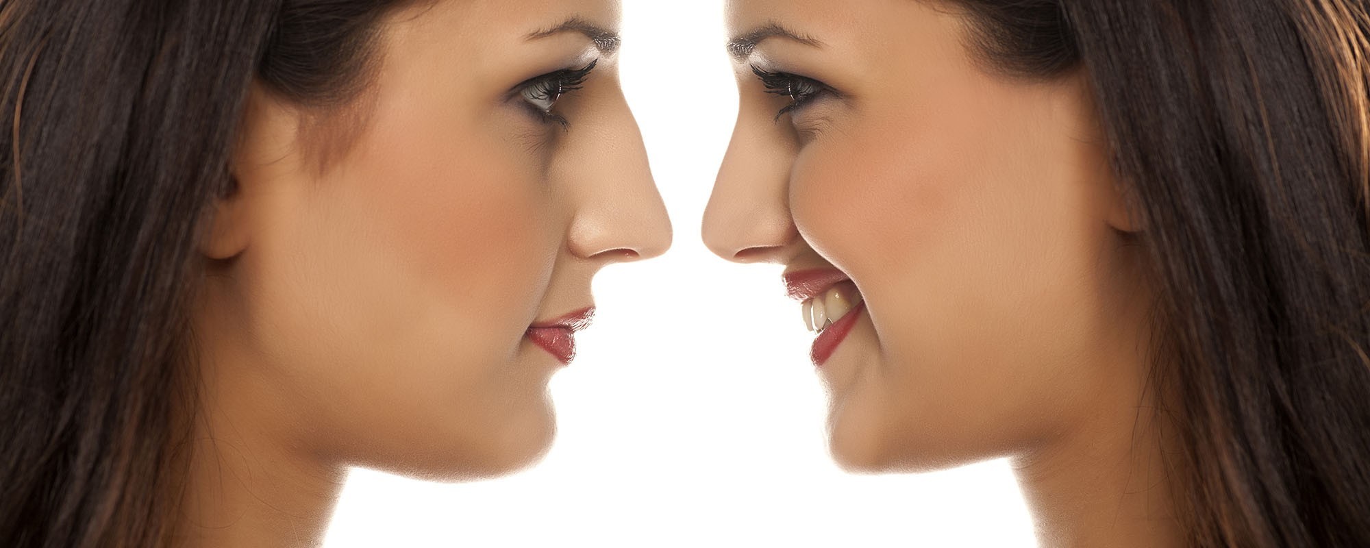 Rinoplastia
