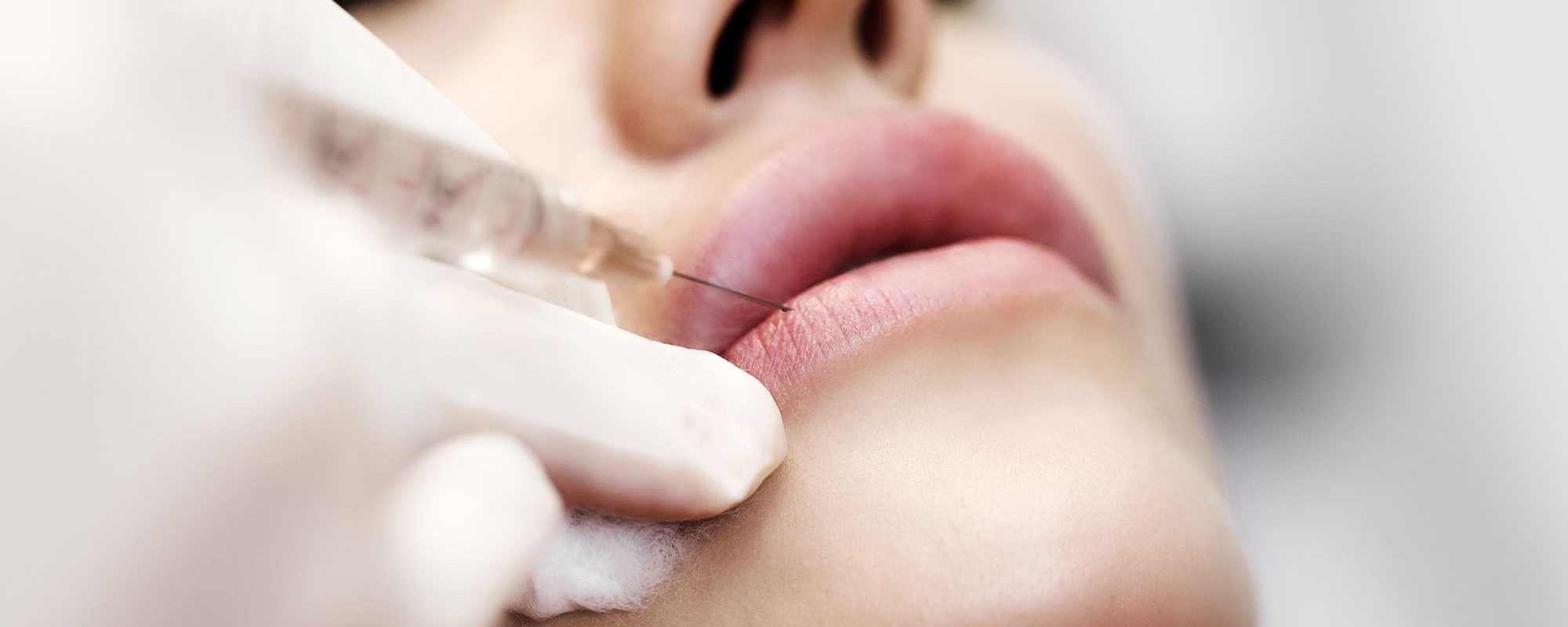 Preenchimento Facial